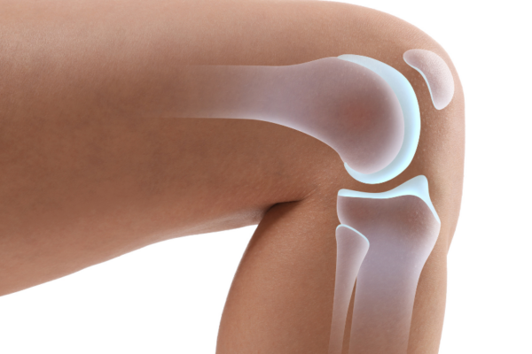 Meniscus Tear