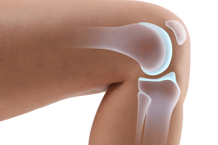 Meniscus Tear